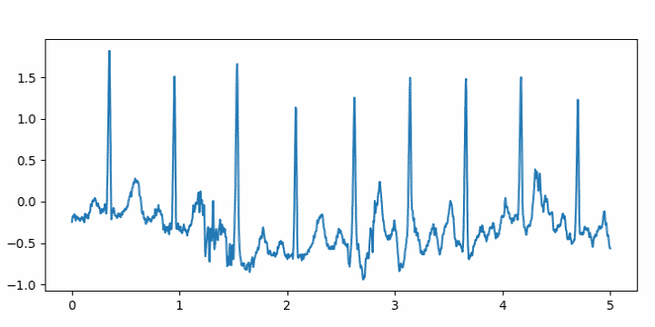 ECG plot